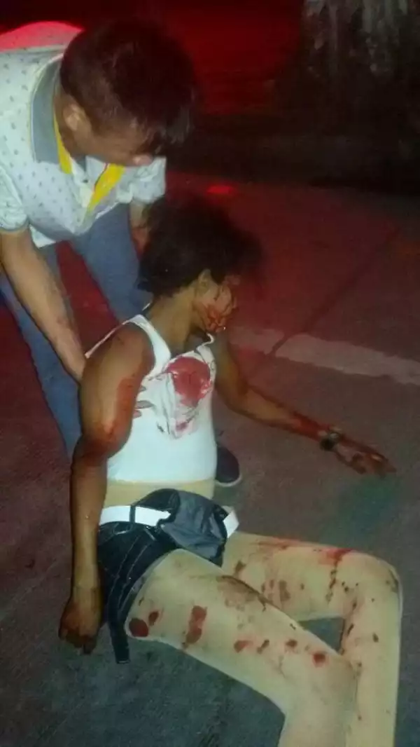 Ugandan Lady Killed After Being Hit By A Speeding Car In China. Graphic Photos